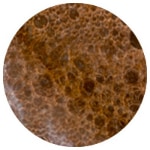 MEDIUM